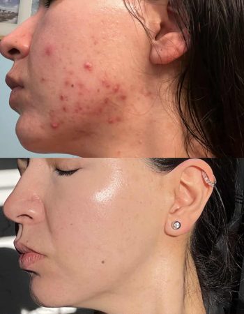 YA Skin Studio – Chicago