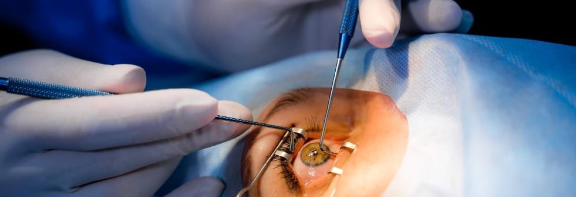 Precision Vision London